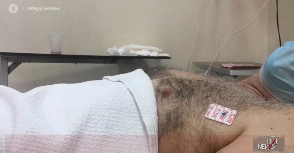 Συμπλοκή στην οδό Μελετίου: Καρέ – καρέ η σοκαριστική περιγραφή του θύματος