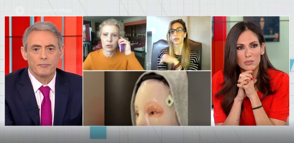 Επίθεση με βιτριόλι: Η γιατρός της & η δημοσιογράφος που πήρε την πρώτη συνέντευξη της Ιωάννας, μιλούν στο MEGA