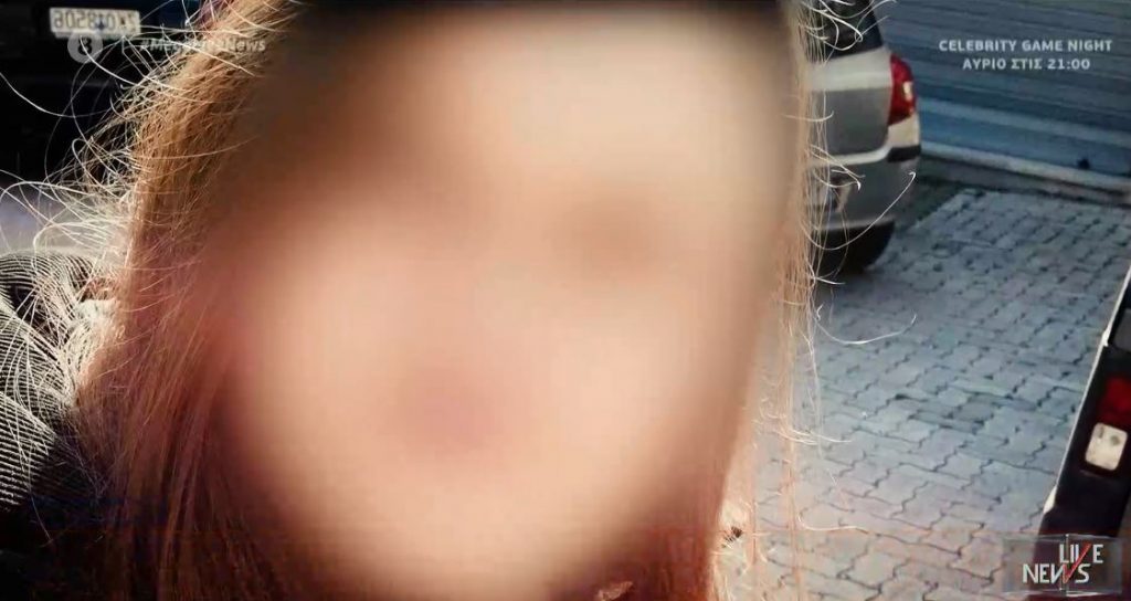 Άγνωστες αλήθειες πίσω από την επίθεση με καυστικό υγρό – Στα ίχνη του δράστη η ΕΛ.ΑΣ.