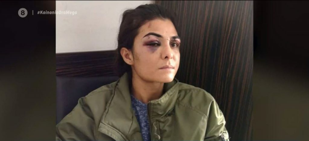 Τουρκία: Αποφυλακίστηκε η Μελέκ Ιπέκ που είχε σκοτώσει τον σύζυγο βασανιστή της