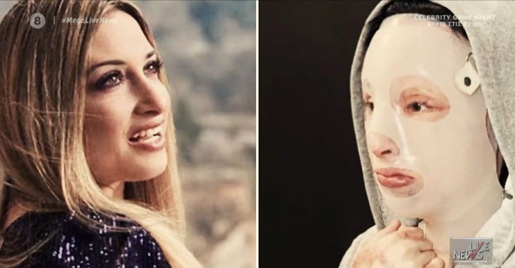 Επίθεση με βιτριόλι: Ένας χρόνος από το πρωινό που άλλαξε τη ζωή της Ιωάννας για πάντα – Το μήνυμά της μέσω του MEGA