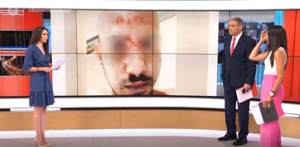 Ναύπακτος: Ομοφοβική επίθεση σε νεαρό – Τον άφησαν αιμόφυρτο έξω από το σπίτι του