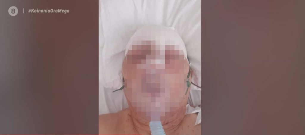 Παξοί: Εννέα χρόνια κάθειρξη σε αγρότη που σακάτεψε αστυνομικό με σιδερολοστό