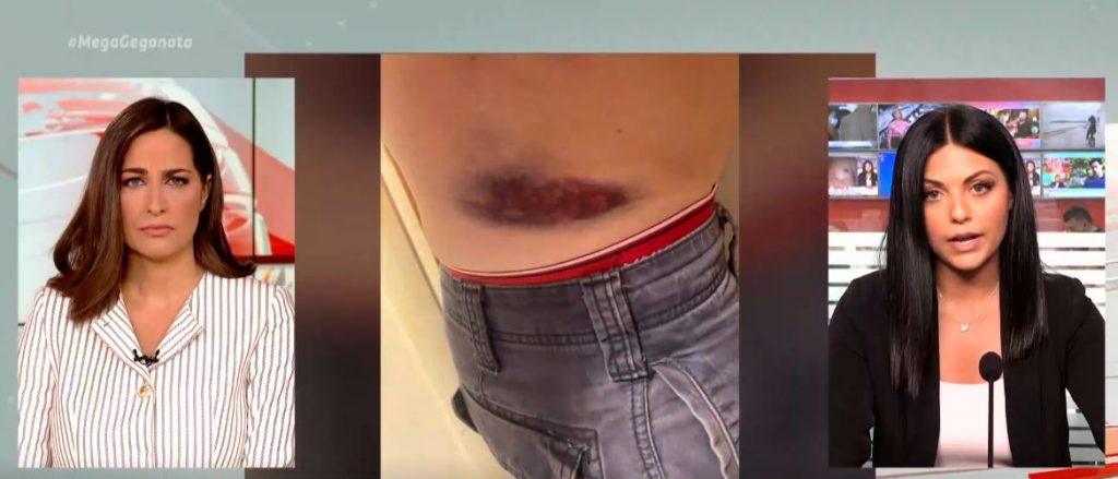 Απίστευτο περιστατικό στο Μετς: Πατέρας και γιος διέταξαν το σκύλο τους να επιτεθεί σε 30χρονο