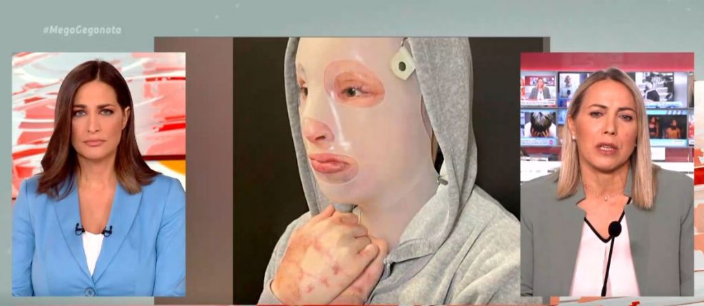 Ξύπνησε μνήμες στην Ιωάννα η επίθεση με καυστικό υγρό στη Μονή Πετράκη – Τι έγραψε στο Instagram