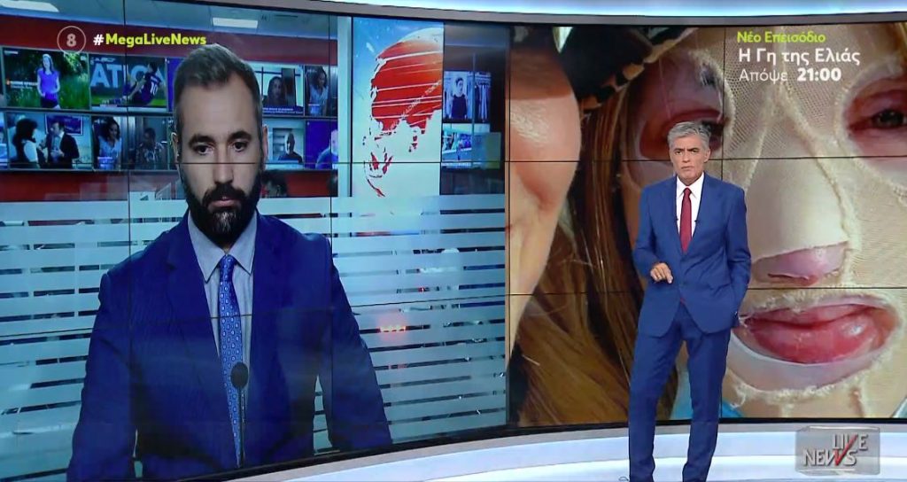 Επίθεση με βιτριόλι – Η δράστρια κρύφτηκε αγχωμένη στο κελί της