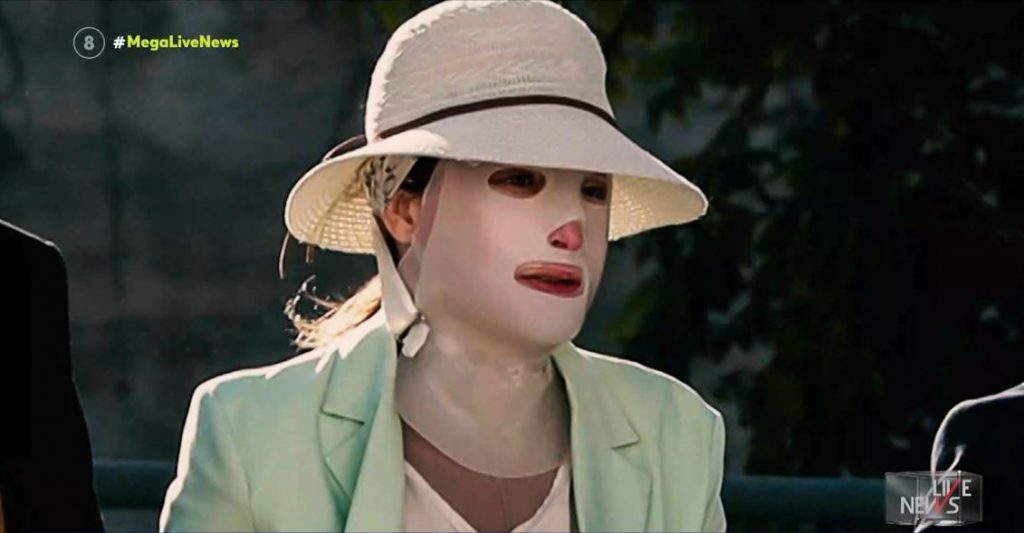 Επίθεση με βιτριόλι – Έχω ψυχική & σωματική αναπηρία – Τρώω με καλαμάκι