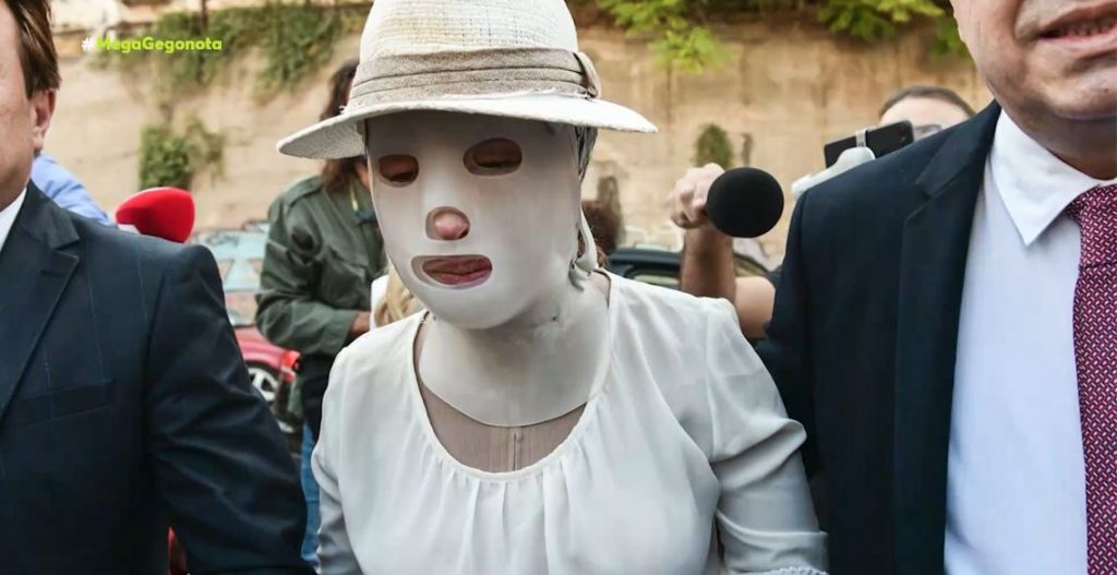 Επίθεση με βιτριόλι – Συγκλονίζει η εικόνα της Ιωάννας Παλιοσπύρου με την προστατευτική μάσκα