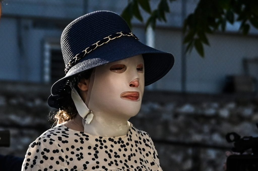 Επίθεση με βιτριόλι – Συγκλονιστικές οι καταθέσεις των γιατρών – Πρόσωπο με πρόσωπο με την «πέτρα» του σκανδάλου