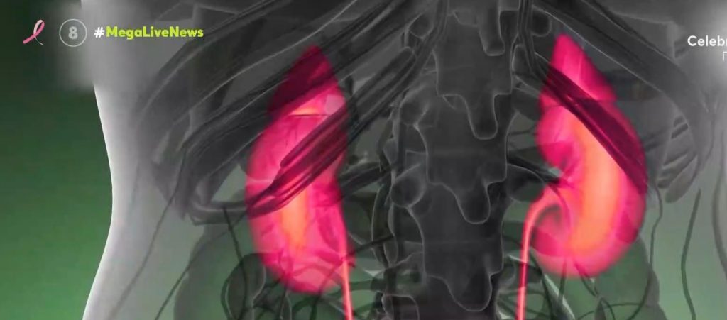 Ιατρικό επίτευγμα- Για πρώτη φορά μεταμόσχευση νεφρού από χοίρο σε άνθρωπο