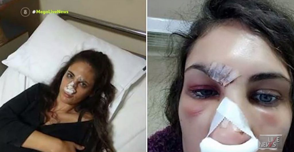 Ναστάζια Μητροπούλου – Παλεύει τρία χρόνια να αναρρώσει από τον ξυλοδαρμό της