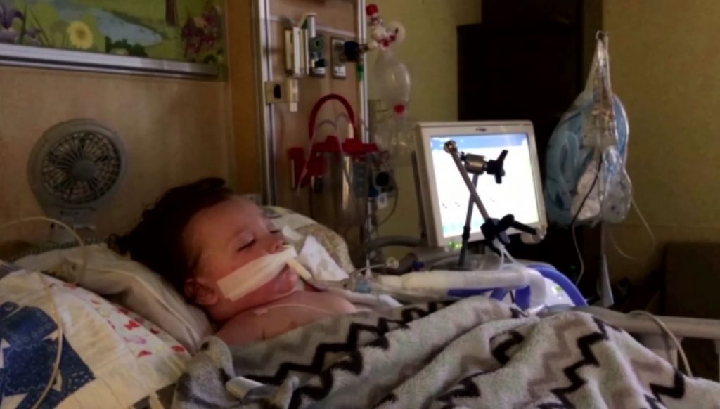 ΗΠΑ- παιδί 2 ετών παλεύει για τη ζωή του σε ΜΕΘ για τον κορωνοϊό