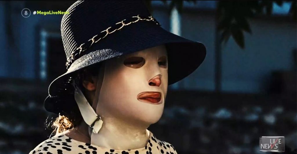 Επίθεση με βιτριόλι – Μαρτυρίες σοκ των γιατρών της Ιωάννας – Τι κατέθεσαν στο δικαστήριο