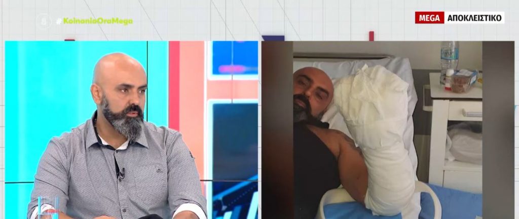 Καταγγελία στο MEGA – Υπέστη εγκαύματα το καλοκαίρι σε πυρκαγιά & ακόμα περιμένει την αποζημίωση