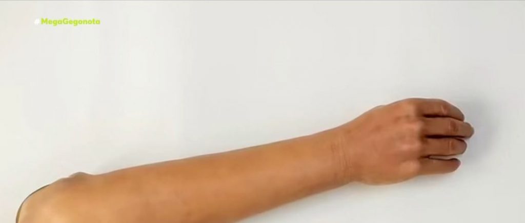 Ιταλία – Αρνητής επιχείρησε να κάνει το εμβόλιο σε ψεύτικο χέρι