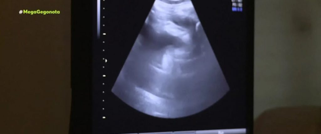 Ο γολγοθάς της 40χρονης που κουβαλούσε νεκρό έμβρυο