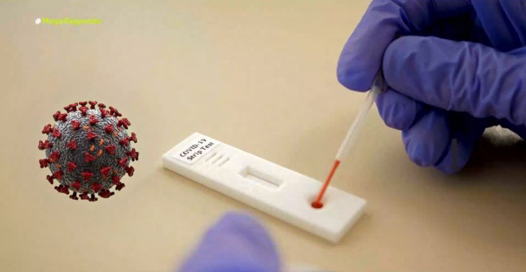 Κορωνοϊός – Πλαφόν στην τιμή των μοριακών tests