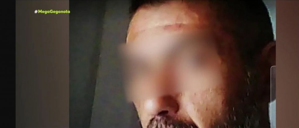 Αργυρούπολη – Με παγωμένο βλέμμα και αμίλητος ο «νταής»