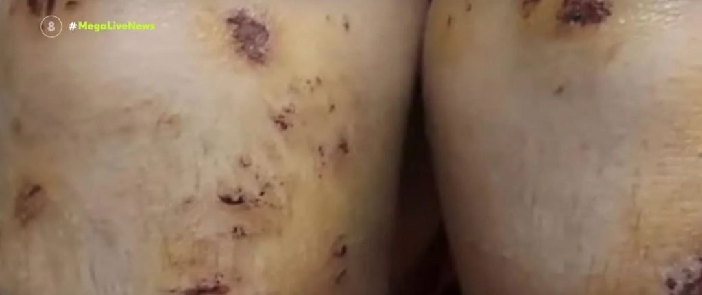 Θεσσαλονίκη: Ταυτοποιήθηκαν οι δράστες της επίθεσης σε 14χρονο & τον 15χρονο αδελφό του