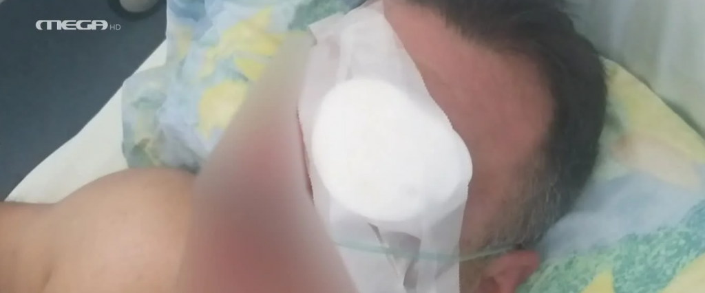 Χανιά: Του ξερίζωσε το μάτι επειδή τον… κοίταξε στραβά