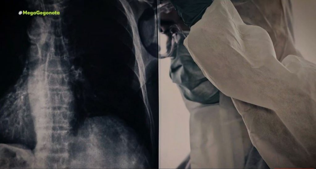 Κορωνοϊός: Θλιβερό ρεκόρ τον Ιανουάριο – Ο χειρότερος μήνας από την αρχή της πανδημίας