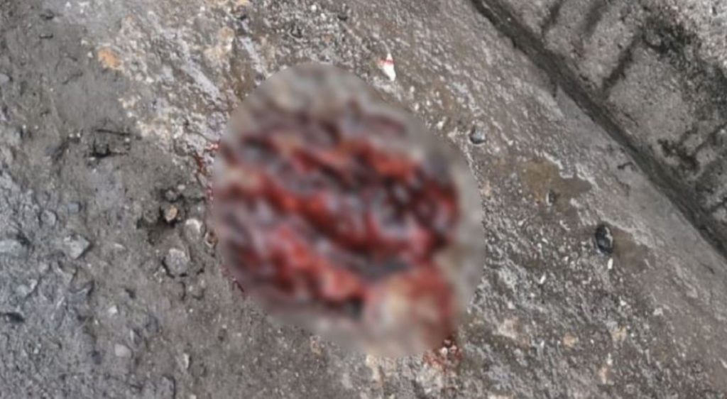 Θεσσαλονίκη: Νεκρός 19χρονος που δέχθηκε επίθεση με δρεπάνι – Οπαδικό το κίνητρο των δραστών