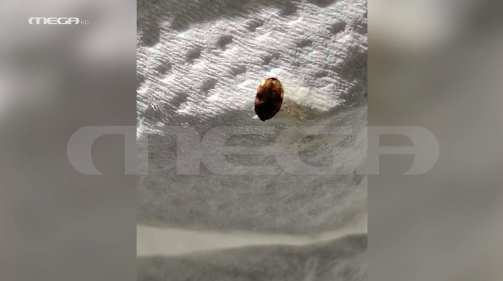 «Euroferry Olympia»: Οδηγοί φορτηγών με σημάδια στο πρόσωπο από κοριούς & ψύλλους