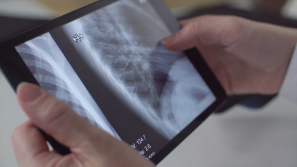 Πάτρα: Η ώρα της αλήθειας στο απόλυτο θρίλερ