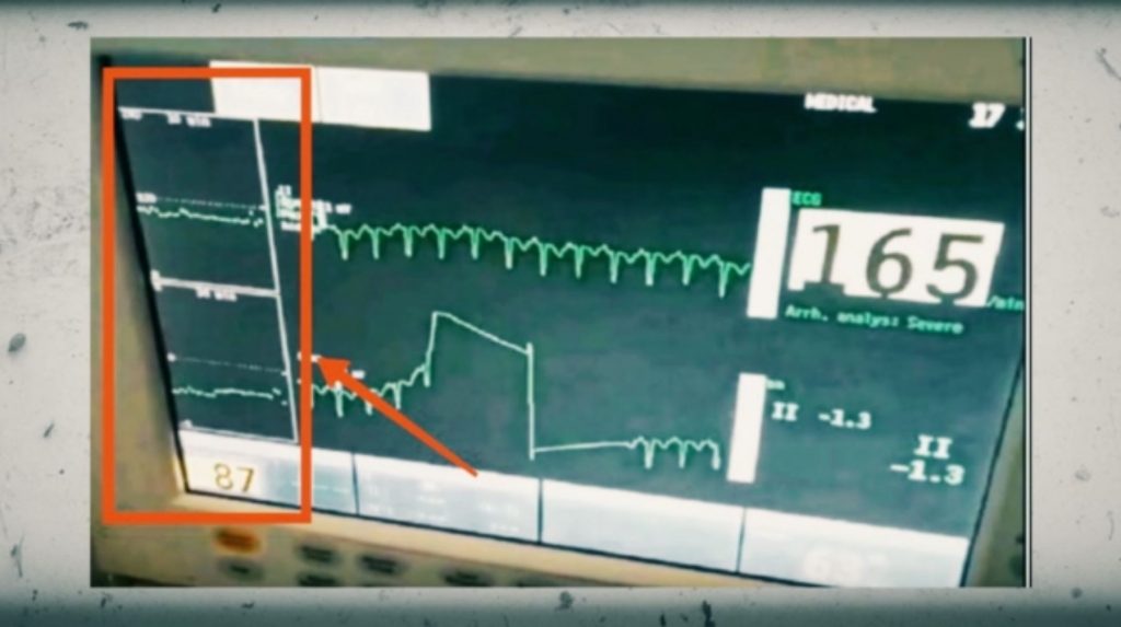 Νέα στοιχεία για το θάνατο της Τζωρτζίνας – Νέο ντοκουμέντο για την καρδιακή της λειτουργία