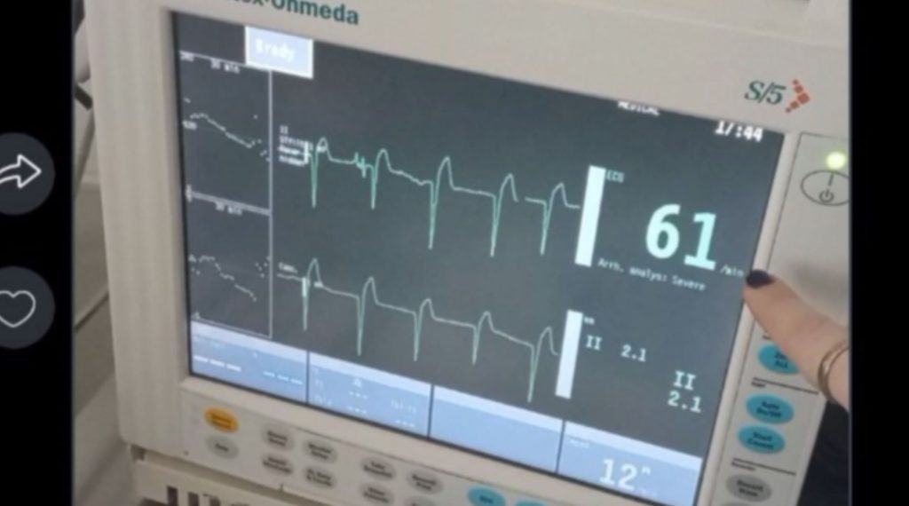 Πάτρα: Φωτογραφία ντοκουμέντο από τη νοσηλεία της Τζωρτζίνας
