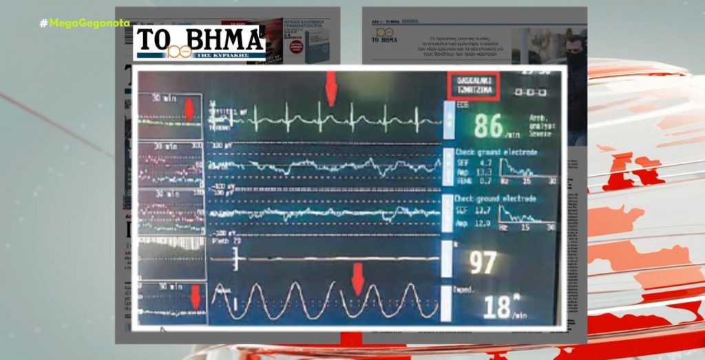 Φωτογραφία ντοκουμέντο από το μόνιτορ της νοσηλείας της Τζωρτζίνας