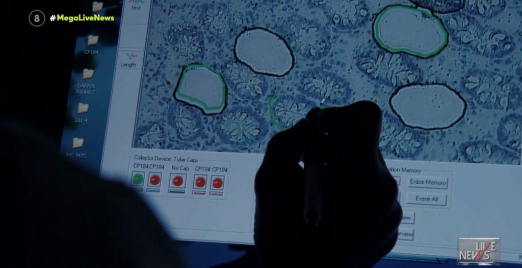 Ανησυχία από την μαζική εμφάνιση κρουσμάτων ηπατίτιδας σε παιδιά