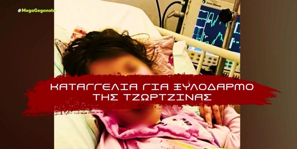 Πάτρα: Καταγγελία για ξυλοδαρμό της Τζωρτζίνας