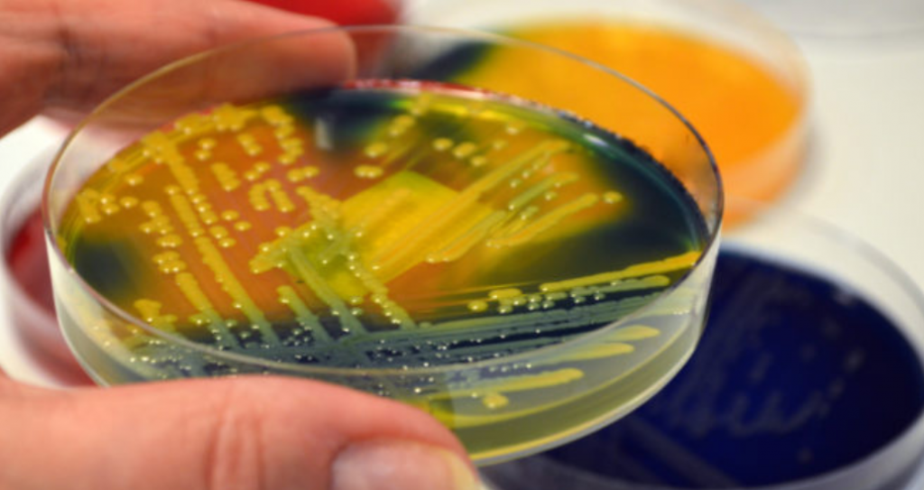 Συναγερμός για τον «Candida Auris» – Ο νέος μύκητας που απειλεί την ανθρωπότητα