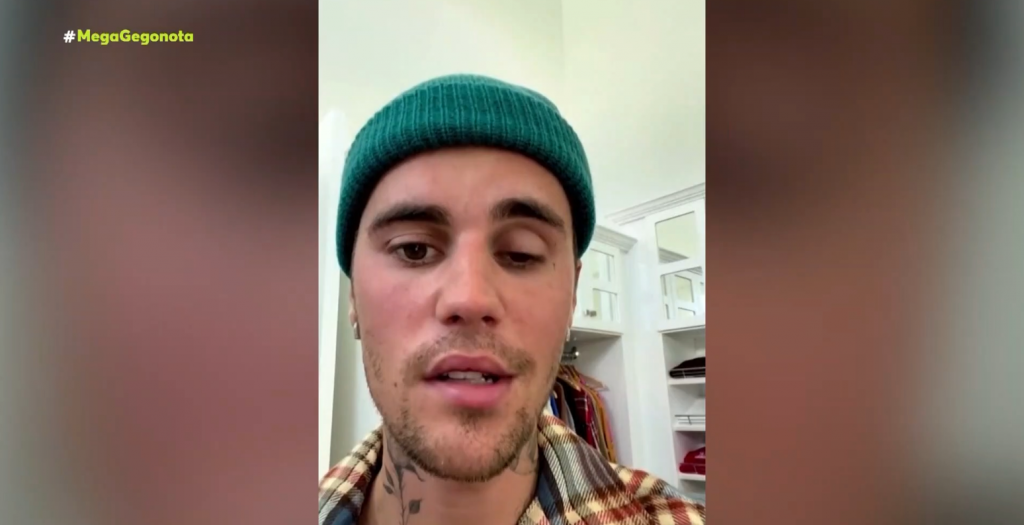 Από σύνδρομο που παραλύει νεύρα του προσώπου πάσχει ο Τζάστιν Μπίμπερ