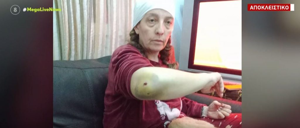 Χίος: Βίντεο ντοκουμέντο από άγρια επίθεση σκύλου