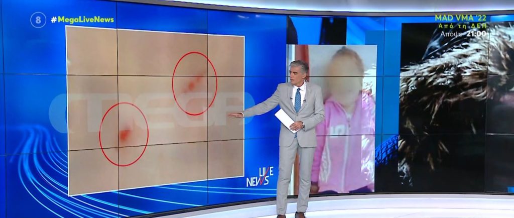 Λέων: Δεν υπάρχει αμφιβολία ότι τα σημάδια της Μαλένας έγιναν εν ζωή