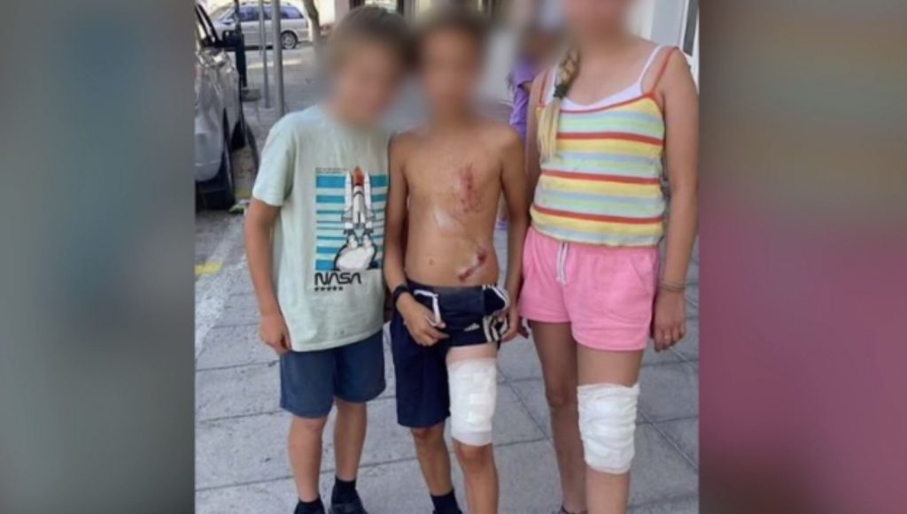 Σουσάκι Κορινθίας: Αγέλη σκύλων επιτέθηκε σε οικογένεια με τρία παιδιά