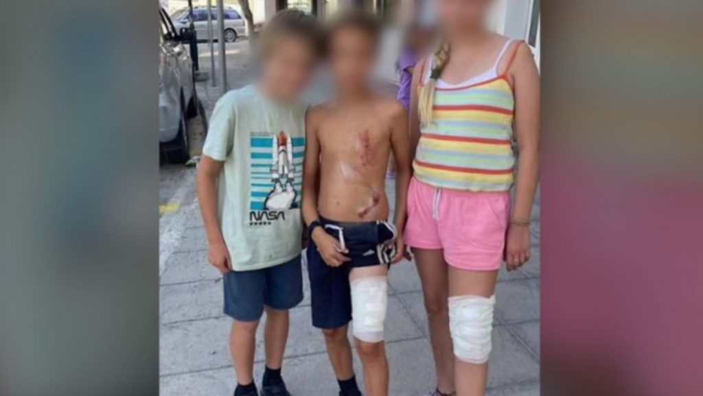 Αγέλη σκύλων επιτέθηκε και τραυμάτισε οικογένεια ομογενών από τη Βρετανία