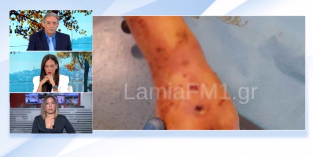 Λαμία: Άγρια επίθεση σκύλου σε 35χρονη – Μήνυση στον ιδιοκτήτη του ζώου θα υποβάλλει το θύμα