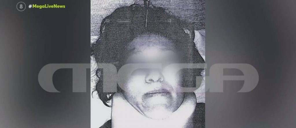 Βούλα: Την χτύπησε με βαριοπούλα στο κεφάλι – Σοκαριστική μαρτυρία