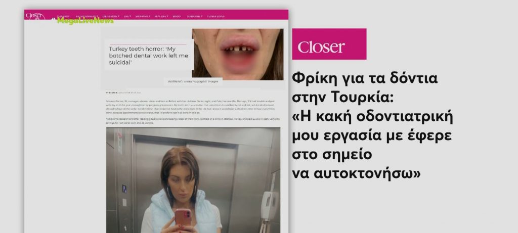 Τουρκία: Φτηνές πλαστικές επεμβάσεις που δεν έχουν τα αναμενόμενα αποτελέσματα