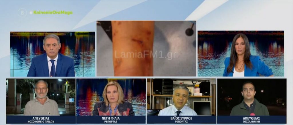 Λαμία: Σκύλος κατασπάραξε 35χρονη – Υπέστη κάταγμα το δεξί χέρι της