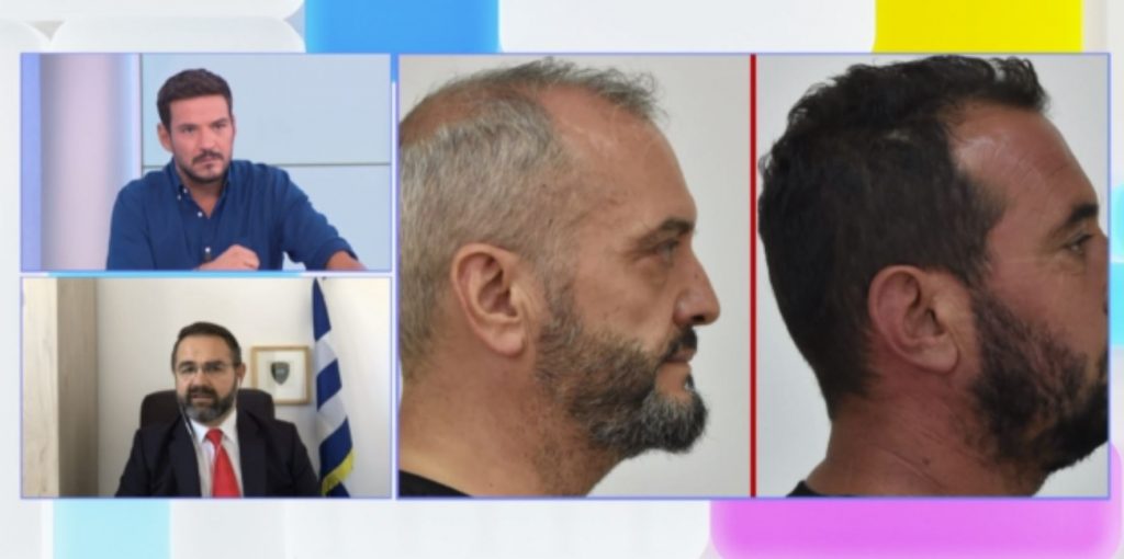 Μπαλάσκας για Σεπόλια: «Η αστυνομία ξεψαχνίζει τα πάντα και τους πάντες»  – Η απάντηση στον Αλέξη Κούγια