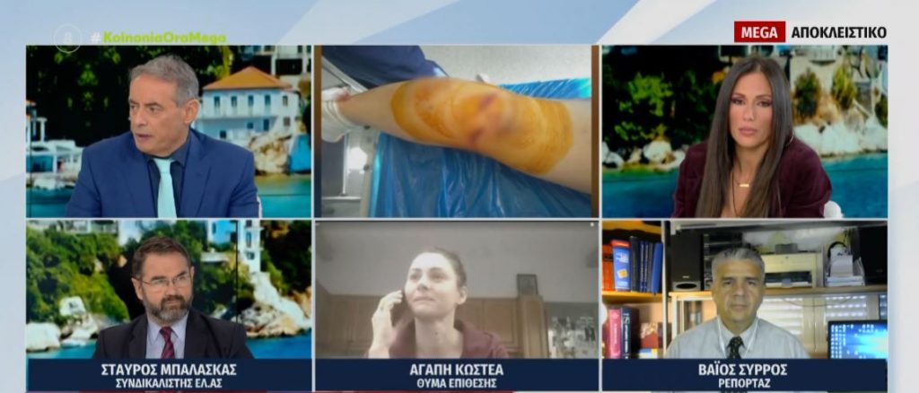 Καλαμάτα: Ο εφιάλτης της γυναίκας που είχαν κατασπαράξει τα σκυλιά – Δύο μήνες μετά είναι άνεργη και δεν έχει ξεπεράσει το σοκ