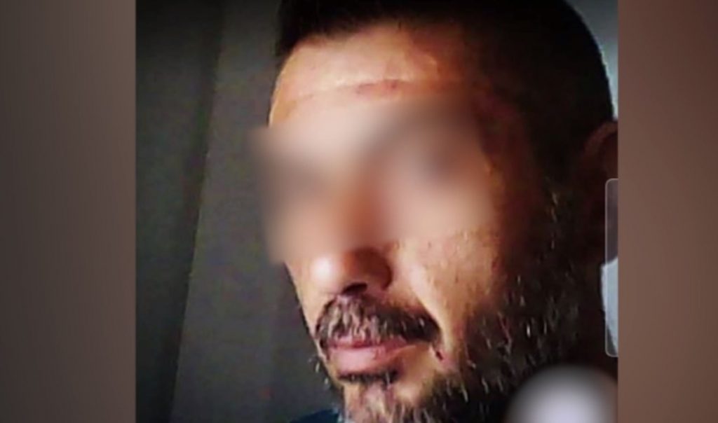 Αργυρούπολη: Πέθανε η 41χρονη Όλγα που είχε κακοποιηθεί βάναυσα από τον σύντροφό της – Θα υπάρξει αλλαγή στην ποινή του;