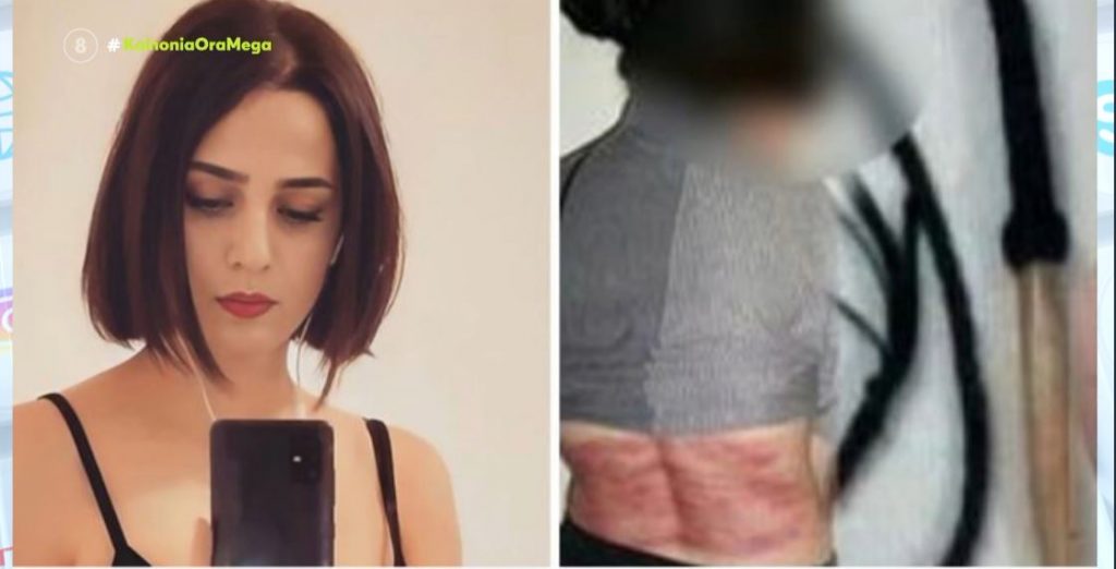 Ιράν: 74 μαστιγώματα σε 33χρονη που δεν φορούσε ισλαμική μαντήλα