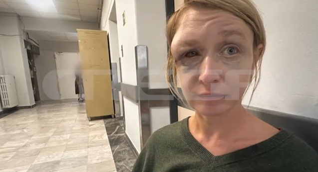 Κορωπί: Η 40χρονη  που ξυλοκοπήθηκε “σπάει” τη σιωπή της στο Live News