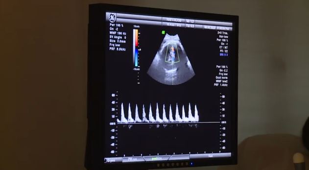 Πανευρωπαϊκό θρίλερ με δότη σπέρματος με αδιάγνωστο γονίδιο καρκίνου