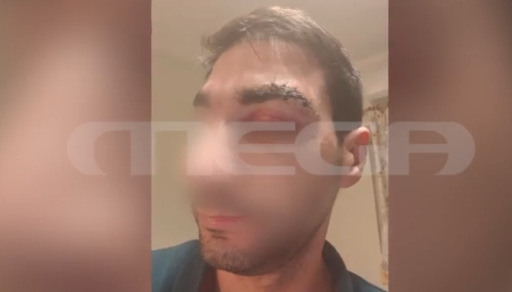 Αίγιο: Ασθενής – μποξέρ χτυπούσε επί 20 λεπτά γιατρό – Τον έστειλε στο χειρουργείο